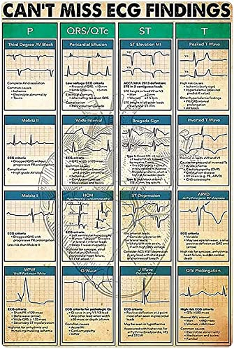 FWJZDSP Metall-Blechschilder „EKG-Wissen“ „Can't Miss Ecg Findings“-Poster, Kardiologen-Guide-Plaketten, Krankenhaus-Klinik-Büros, wissenschaftliche Wanddekoration, 20,3 x 30,5 cm