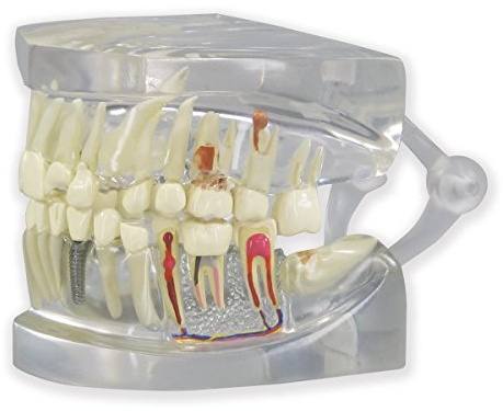 GPI Anatomicals 2861 Gebiss Modell durchsichtig mit Zähnen