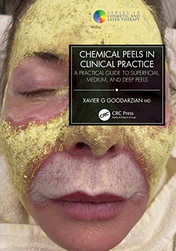 Chemical Peels in Clinical Practice: A Practical Guide to Superficial, Medium, and Deep Peels (In Cosmetic and Laser Therapy)
