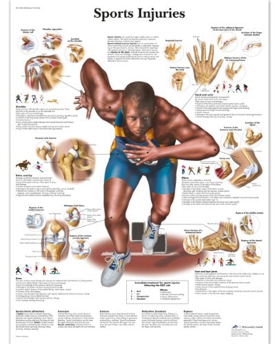 3B Scientific VR1188L Anatomie des Menschen – Schaubild der Sportverletzungen, laminierte Version