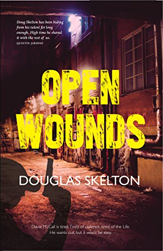 Open Wounds (Davie Mccall)