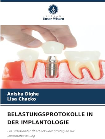 BELASTUNGSPROTOKOLLE IN DER IMPLANTOLOGIE: Ein umfassender Überblick über Strategien zur Implantatbelastung