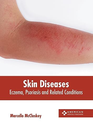 Skin Diseases: Eczema, Psoriasis and Related Conditions