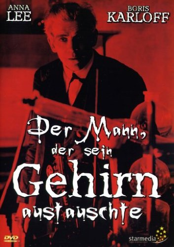 Der Mann, der sein Gehirn austauschte