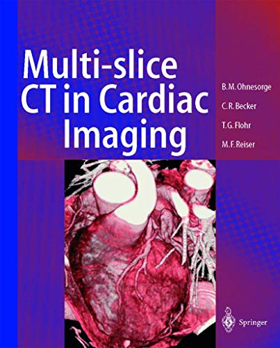 Multi-slice CT in Cardiac Imaging: Technical Principles, Imaging Protocols, Clinical Indications and Future Perspective