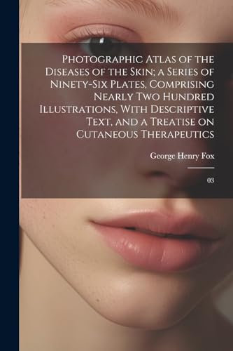 Photographic Atlas of the Diseases of the Skin; a Series of Ninety-six Plates, Comprising Nearly two Hundred Illustrations, With Descriptive Text, and a Treatise on Cutaneous Therapeutics: 03
