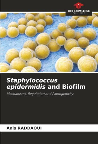 Staphylococcus epidermidis and Biofilm: Mechanisms, Regulation and Pathogenicity