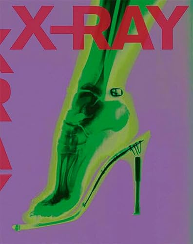 X-RAY: The Power of Röntgen Vision
