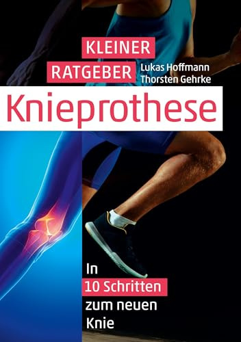 Kleiner Ratgeber Knieprothese: In 10 Schritten zum neuen Knie