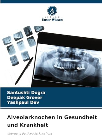 Alveolarknochen in Gesundheit und Krankheit: Übergang des Alveolarknochens