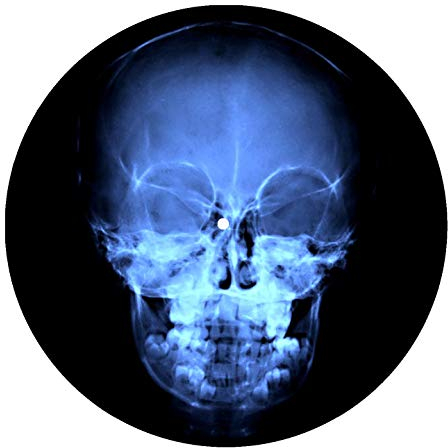 X Ray Skull DJ Slipmat vinilo tocadiscos Técnicas
