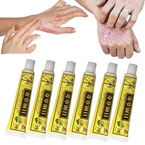 Crèmes Naturelles Chinoises D’eczéma à Base De Plantes, Crème Naturelle à Base De Plantes, Dermatite Et Eczéma Prurit Pommade Psoriasis (6pcs)