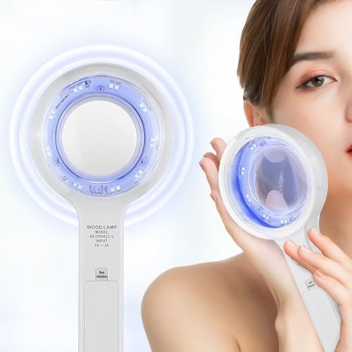 HKFGSHOP Tragbares Gesichtssalon-Schönheitsanalyse-Lampenlicht, Drahtloses Woods-Lampen-Hautanalysegerät, 3-fache Vergrößerung, Hautdiagnoselicht, Vitiligo, Psoriasis-Test Zu Hause
