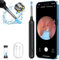 Oxbird Ear Wax Removal Kit Tool with Camera, 1080P Wireless Earwax Camera Ear Camera Otoscope Cleaner Smart Ear Cleaner with Camera and Light for iPhone, Ipad & Android Smart Phones (Black)