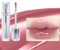 Judy Doll Lip Gloss, Feuchtigkeitsspendender Jelly-Lipgloss Lippentönung, 2024 Spiegel-Lipgloss Mit Metallapplikatorspitze - Langanhaltend Und Nicht Klebend(11#)