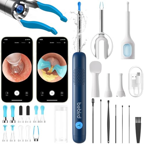 BEBIRD R1 Ultra Ohrenschmalz Entferner Kamera, Ohrenreiniger Komplett-Set mit Sichtbarer Dropper & Pinzette-Blau