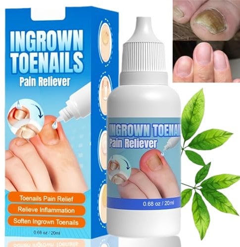 Ingrown Toenail Treatment Extra Strong,Fungal Nail Treatment for Toenail,Ingrowing Toenail Treatment,Treatment for Ingrown Toenail,Cuticle Care Oil for Ingrown Toenails,Nail Repair for Damaged Nails