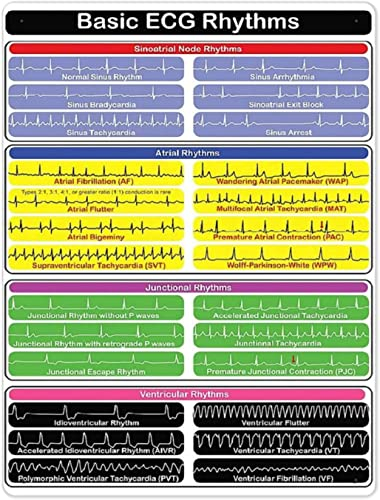 Metall-Wandschild, 30 x 20 cm, grundlegendes EKG-Rhythmus-Diagramm, Kardiologie, Wissen, Metallschilder, Vintage-Metallschild, Poster, elegantes Metallschild, Plakette für Restaurant, Fledermaus