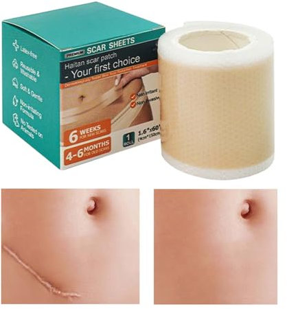 Pansement Silicone Cicatrice Anti UV(4 Cm × 150 Cm), Silicone Scar Sheets Bande En Réutilisable Et Douce Pour La Peau, Pour Césariennes, Chirurgies, Brûlures, Chéloïdes Et Acn