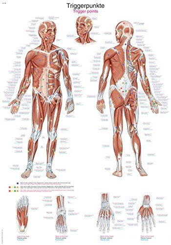 Erler-Zimmer Lehrtafel Triggerpunkte, 50x70cm, Wandbild, Klassenzimmer