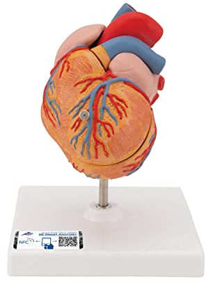 3B Scientific Menschliche Anatomie - Klassik-Herzmodell mit linksventrikulärer Hypertrophie (LVH), 2-teilig + kostenlose Anatomie App - 3B Smart Anatomy, G04