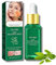 Tea Tree Ance Treatment Serum, Tea Tree Oil For Skin, Tea Tree Essential Oils, Anti-Pimples and Acne, Moisturizer and Brighten Skin.Tea Tree Oil for Diffuser, Humidifier, DIY, Home, Office 17ml