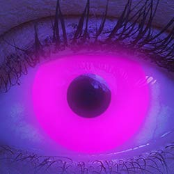 Farbige UV Kontaktlinsen 1 Paar Pinke Schwarzlicht Glow Pink Neon Farblinsen. Jahreslinsen Topqualität zu Halloween, Fasching, Fastnacht, Karneval inkl. Kontaktlinsenbehälter - Ohne Stärke
