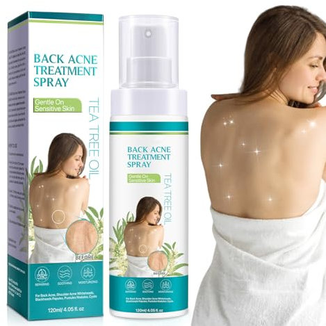 Back Acne Treatment, Tea Tree Oil Back Acne Spray, Body Acne Treatment for Spots & Acne Marks, Fast-Acting Back & Chest Acne Moisturising Acne for Back, Body, Chest