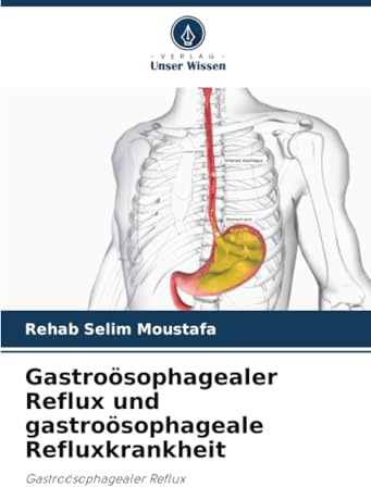 Gastroösophagealer Reflux und gastroösophageale Refluxkrankheit: Gastroösophagealer Reflux
