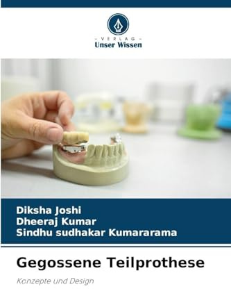 Gegossene Teilprothese: Konzepte und Design