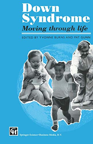 Down Syndrome: Moving through life