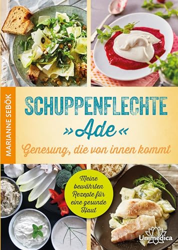 Schuppenflechte Ade - Genesung, die von innen kommt: Meine bewährten Rezepte für eine gesunde Haut
