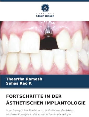 FORTSCHRITTE IN DER ÄSTHETISCHEN IMPLANTOLOGIE: Von chirurgischer Präzision zu prothetischer Perfektion: Moderne Konzepte in der ästhetischen Implantologie