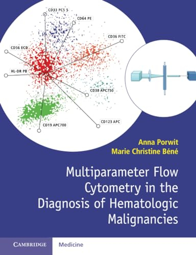 Multiparameter Flow Cytometry in the Diagnosis of Hematologic Malignancies