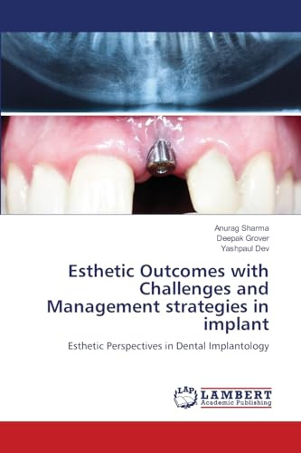 Esthetic Outcomes with Challenges and Management strategies in implant: Esthetic Perspectives in Dental Implantology