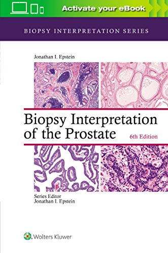 Biopsy Interpretation of the Prostate (Biopsy Interpretation Series)