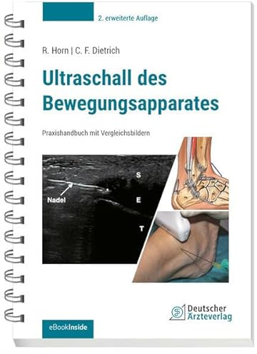 Ultraschall des Bewegungsapparates: Praxishandbuch mit Vergleichsbildern