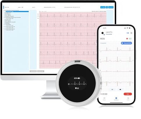 CheckMe LepodPro ECG portable à 12 fils avec écran OLED, enregistrement ECG en temps réel pendant 24 heures, marqueurs d'événements, rapport ECG AI détaillé, support rechargeable pour les applications
