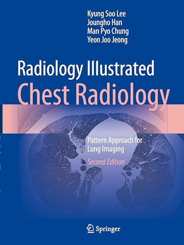 Radiology Illustrated: Chest Radiology: Pattern Approach for Lung Imaging