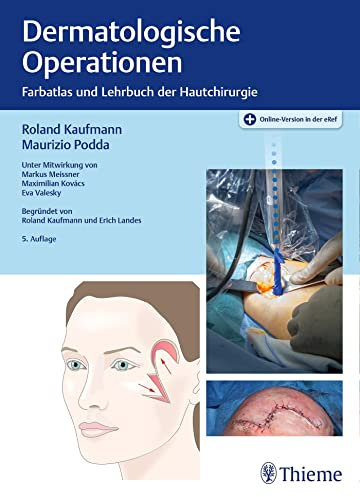 Dermatologische Operationen: Farbatlas und Lehrbuch der Hautchirurgie