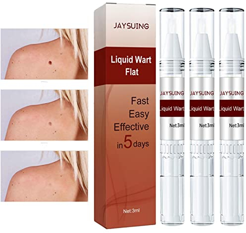 Wipe Off Moles Remover, Extreme Skin Tag Wipe Off Tags and Mole Remover, Liquid Mole Removal, Instant Painless Liquid Removal Gel for Skin Warts Tag Mole, Easy for Face, Body, Neck, Armpit