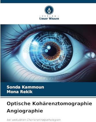 Optische Kohärenztomographie Angiographie: bei vaskulären Chorioretinalpathologien