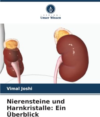 Nierensteine und Harnkristalle: Ein Überblick: DE