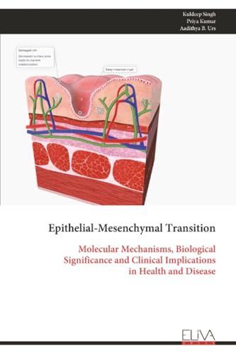 Epithelial-Mesenchymal Transition: Molecular Mechanisms, Biological Significance and Clinical Implications in Health and Disease