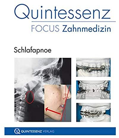 Quintessenz Focus Zahnmedizin: Schlafapnoe