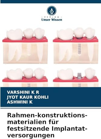 Rahmen-konstruktions-materialien für festsitzende Implantat-versorgungen