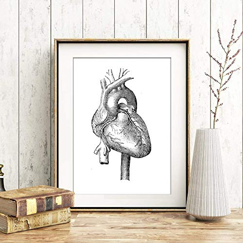 Din A4 Kunstdruck ungerahmt Anatomie Herz Herzkranzgefäße Kardiologie Medizin Arzt Druck Poster Bild