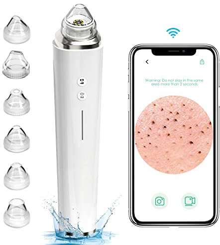 Mitesserentferner mit Kamera, prabensei Mitesserentferner Vakuum Mitesser Sauger Porenreiniger mit 20X Mikroskop 5.0 Megapixel Kamera, 3 Saugstufen&6 LED-Licht&6 Sonden für die Gesichtshautreinigung