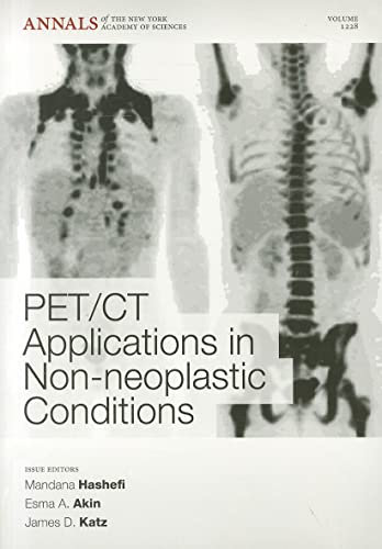 PET/CT Applications in Non-neoplastic Conditions (Annals of the New York Academy of Sciences, Band 1228)