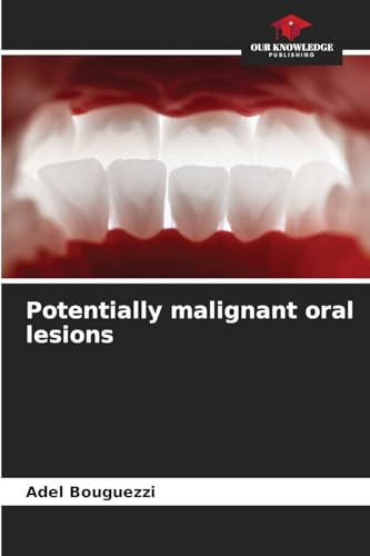Potentially malignant oral lesions: DE